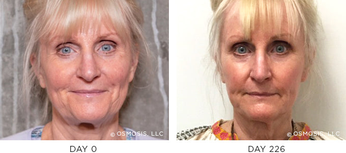 Before and After Aging Results